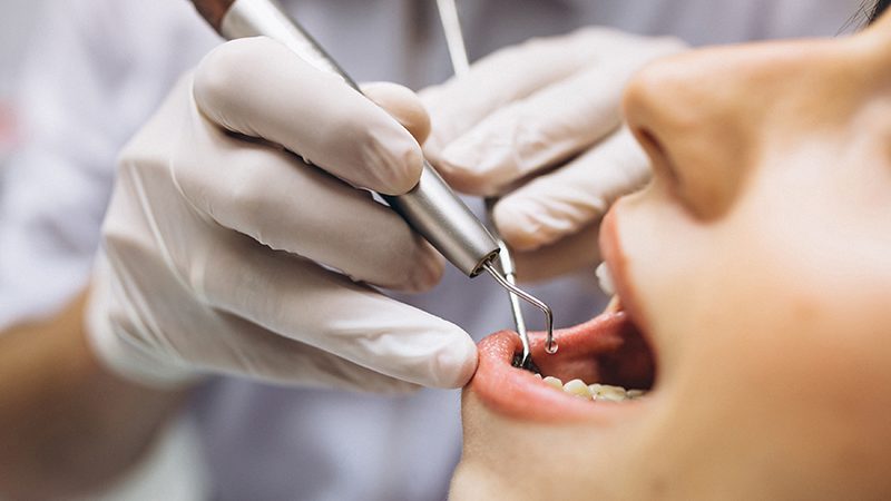 Tipos de fio dental: conheça os principais e as indicações! - CCO