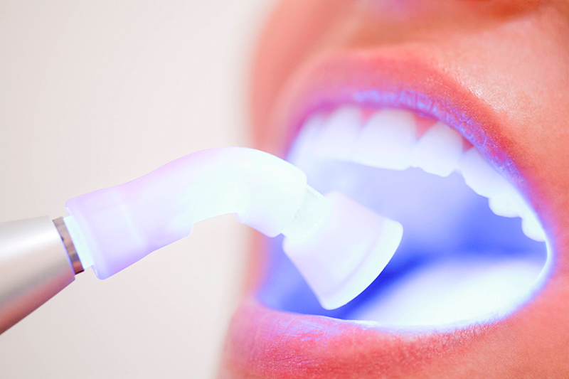 Motivos para não parar o tratamento ortodôntico: veja! - Dental Arte